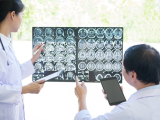 NattoEnzym nâng cao nhận thức cộng đồng về Ngày Đột quỵ Thế giới